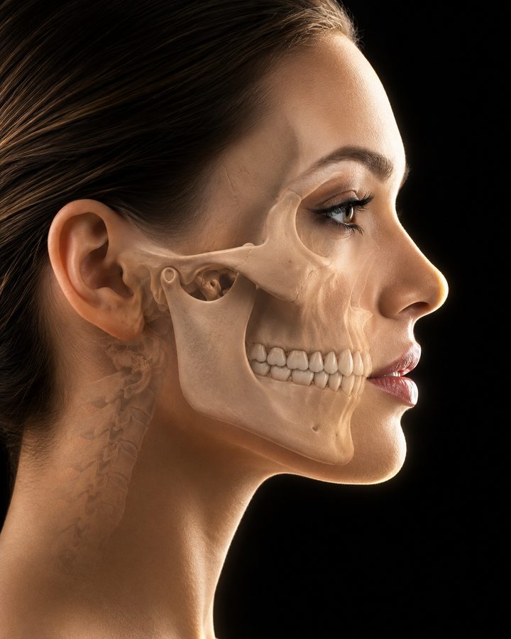Representação 3D da face e mandíbula para cirurgia ortognática